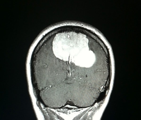 An update for all my peeps…