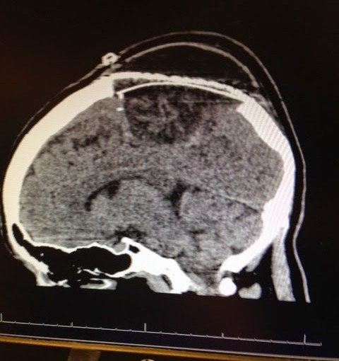 longest run-on post ever…